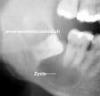 Ciszta